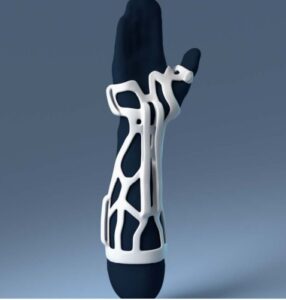 A2 – Wrist & forearm thumb support