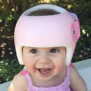 Custom made scanned cranial molding helmet for plagiocephaly