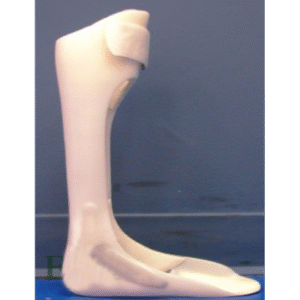 FLOOR REACTION ORTHOSIS(FRO)