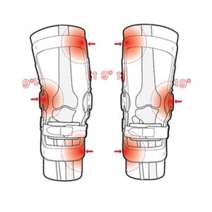 Thuasne OA knee brace 1